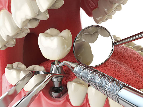 Best Walk-In Emergency Dentist in Senoia, GA