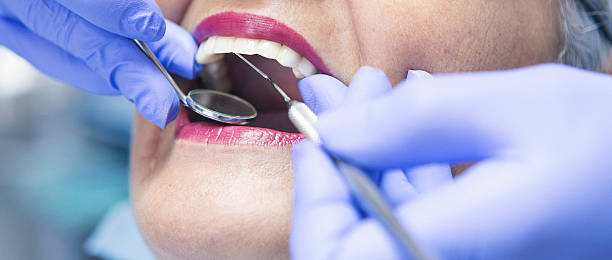 Best Emergency Tooth Extraction in Senoia, GA